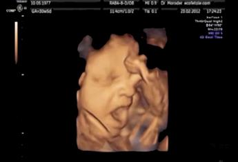 Does your foetus get bored? Unborn baby yawns in 4D video
