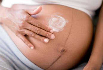Skin changes to expect while you’re pregnant