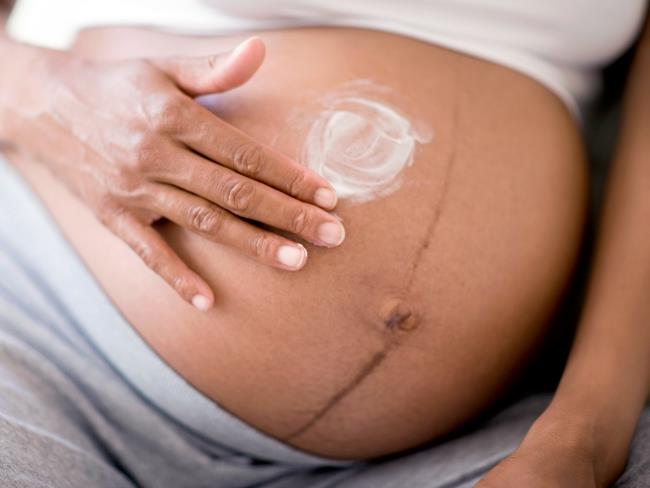Skin changes in pregnancy