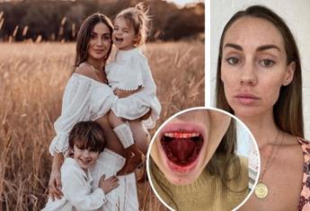 Influencer Krystal Hipwell gets real about her pregnancy health: Cellulite, varicose veins and bleeding gums