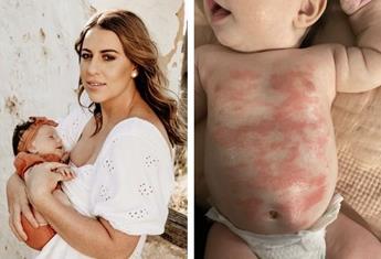 REAL LIFE: “My baby’s skin rash cleared up within 24 hours of using this supermarket moisturiser”