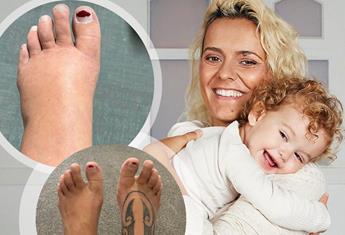 Ouch! Moana Hope’s postpartum feet are sweet relief from her pregnancy swelling